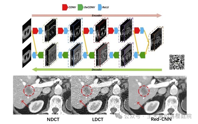 #108 CT重建的3D深度学习技术——深度学习图像重建算法分类2 #108 CT重建的3D深度学习技术——深度学习图像重建算法分类2